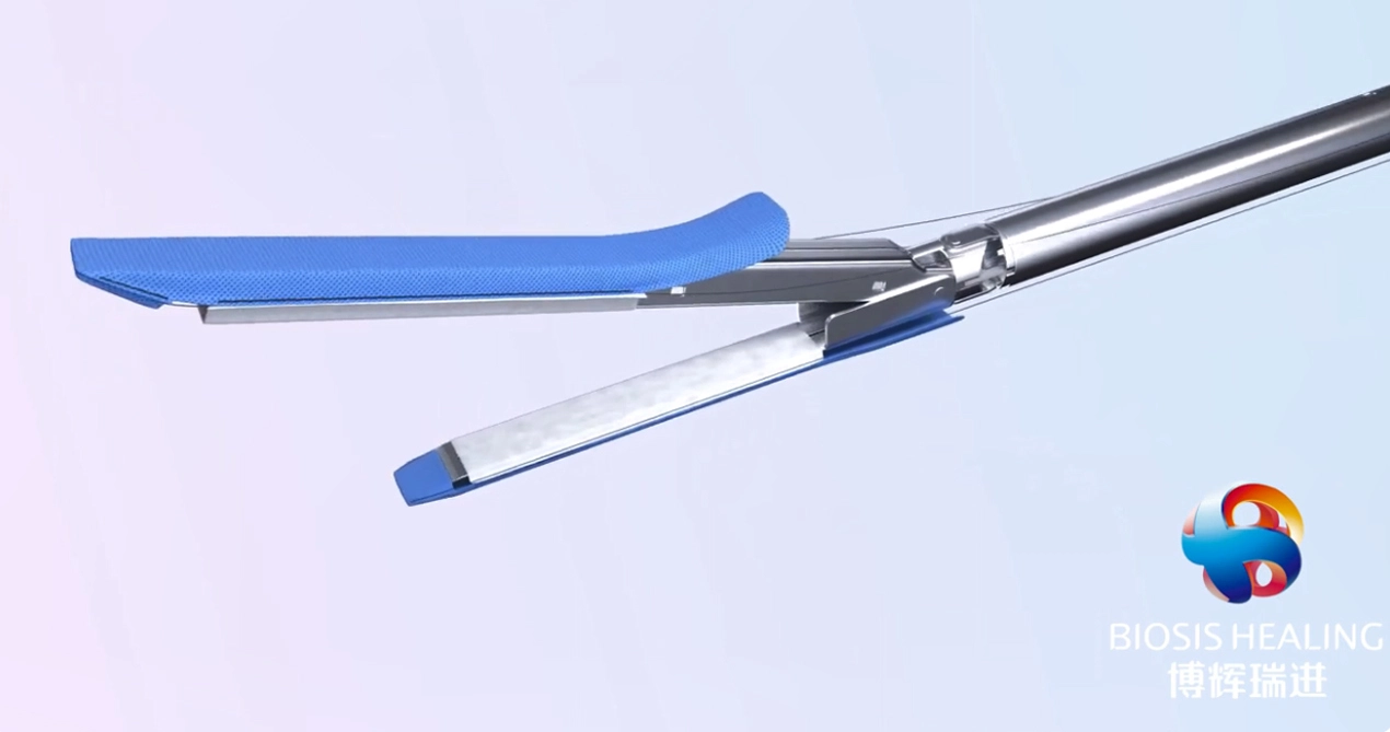 Renforcement de la ligne d'agrafe pour la gastrectomie à manchon pour la chirurgie bariatrique