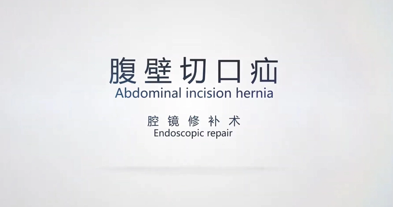Réparation de hernie d'incision abdominale
